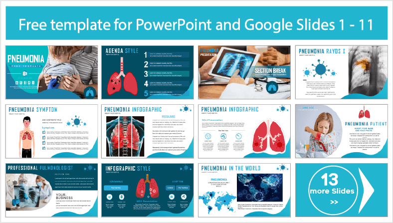 Laden Sie kostenlose Pneumonie bei Kindern PowerPoint-Vorlagen und Google Slides-Themen herunter.