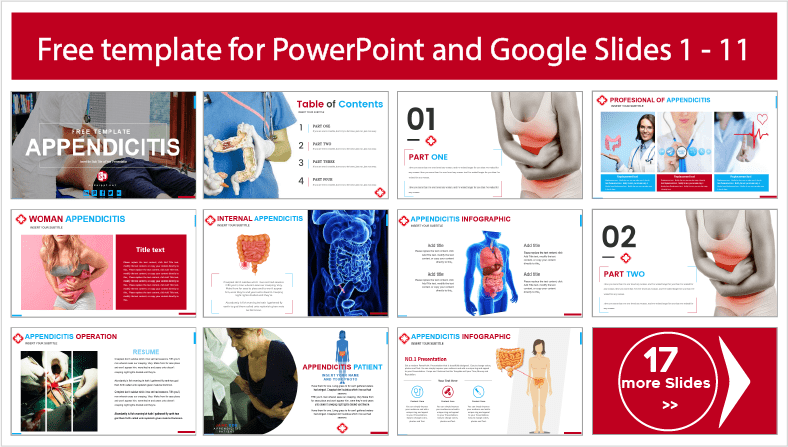 Téléchargez gratuitement les modèles de symptômes et de causes de l'appendicite pour les thèmes PowerPoint et Google Slides.